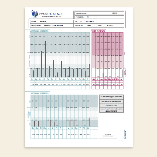 Laboratory test result sheet with bar graphs and text on a beige background
