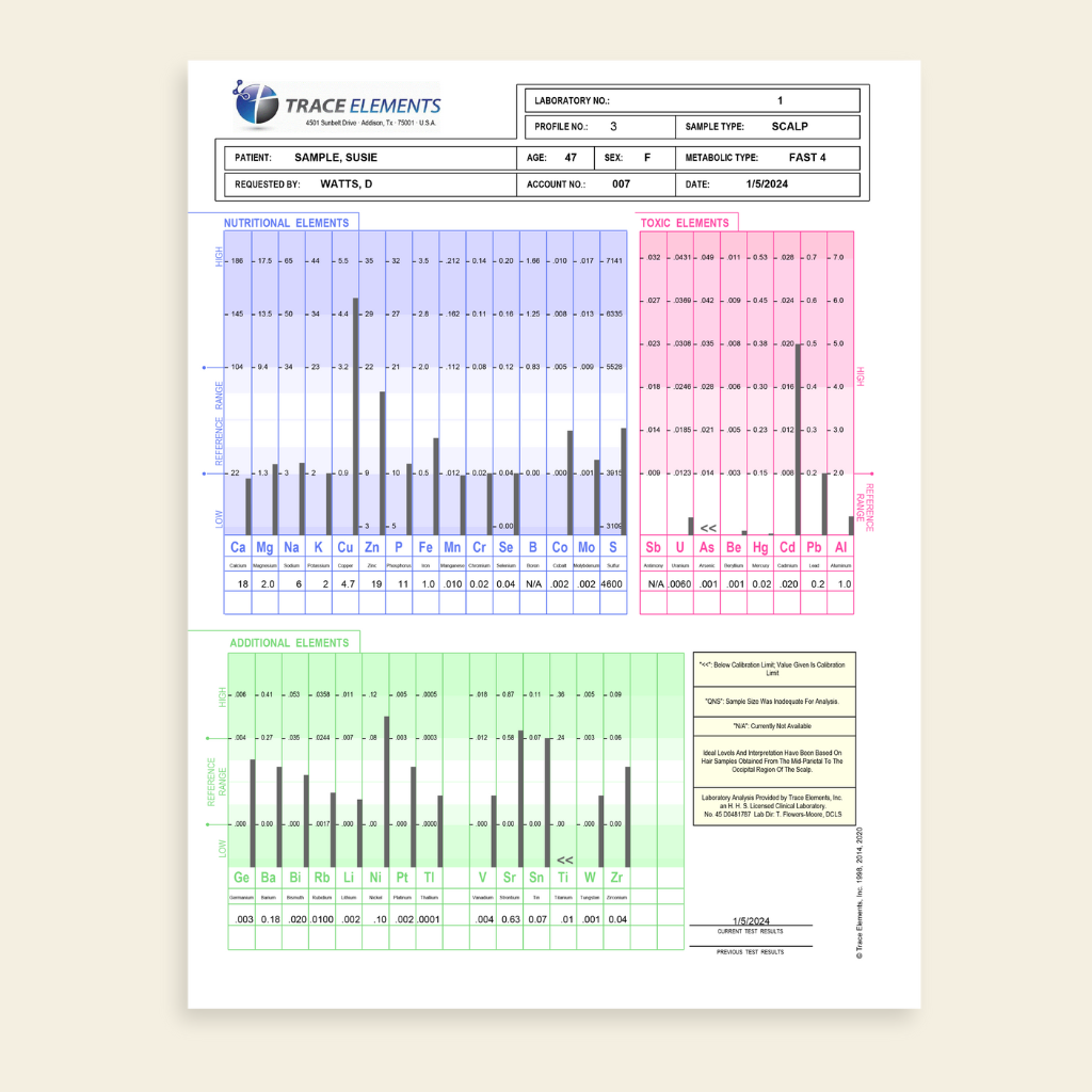 Lab test result sheet for trace elements on a beige background