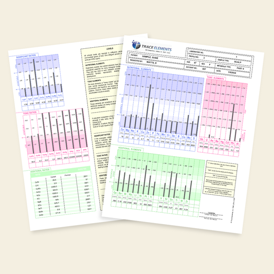 Three printed sheets with bar graphs and text on a beige background